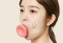 姑娘你这包扎的位置不对啊-资源分享网