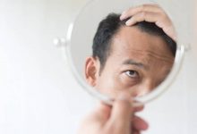 掉髮、白髮很严重怎么办? 中医教3招养出黑髮-资源分享网