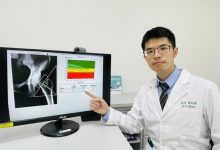 50岁以上女性要留意 小心骨质疏鬆缠身-资源分享网