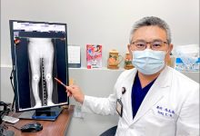 七旬翁O型腿40年 关节内矫正微创术让双腿变直了-资源分享网