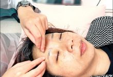 美颜微针 抚平口罩下脸部细纹-资源分享网