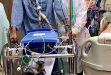 戴呼吸器2年等到肺移植！ 妇产科名医林禹宏下床：坚持才看到希望-资源分享网