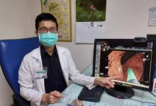 8旬老妇大肠多处急性出血 氩气电烧助止血-资源分享网