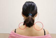 姿势又不良苗条女「虎背熊腰」施打肉毒桿菌舒缓肩颈痠痛-资源分享网