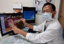 男子胆囊塞满2000颗胆结石 造成黄疸併发胆管炎及肝炎-资源分享网