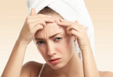 6种痘痘药膏功能一次搞懂！ 药师吁勿乱用-资源分享网