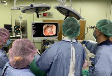 6旬男便秘3个月 大肠镜检揪出瘜肉 幸未癌化-资源分享网