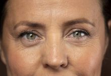 想消除恼人细纹 先了解这「3」成因-资源分享网