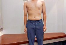 少年爱吃滷肉飙到83公斤 饮食控制4个月甩11公斤-资源分享网