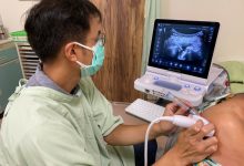 五十肩的肩痛 可用超音波导引注射缓解-资源分享网