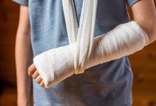 骨折了怎样快速养好身体？-资源分享网